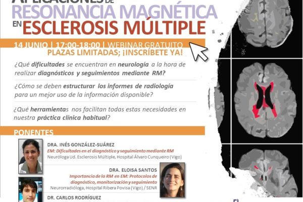 Webinar Qubiotech Esclerosis Múltiple