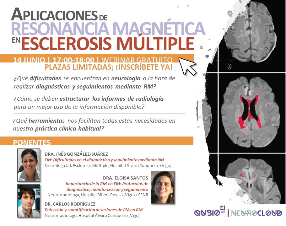 Webinar Qubiotech Esclerosis Múltiple